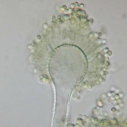 fungus_3299220.jpg