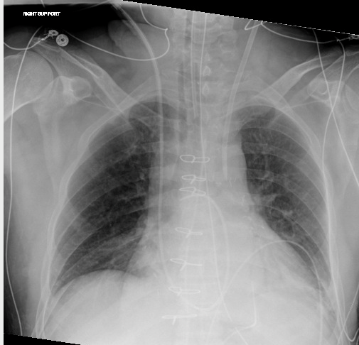 Radiograph of patient.